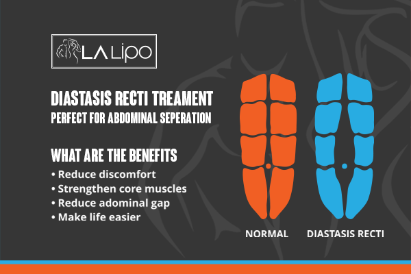 When to Be Concerned About Abdominal Muscle Changes Lancaster