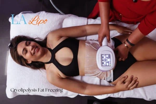 woman getting cryolipolysis Lancaster