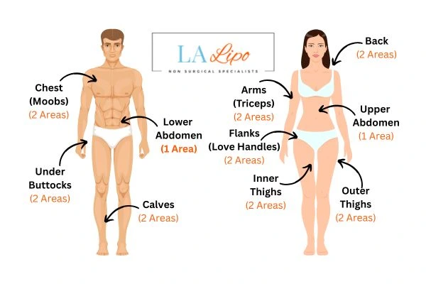 LA LIPO Cryolipolysis Areas Lancaster