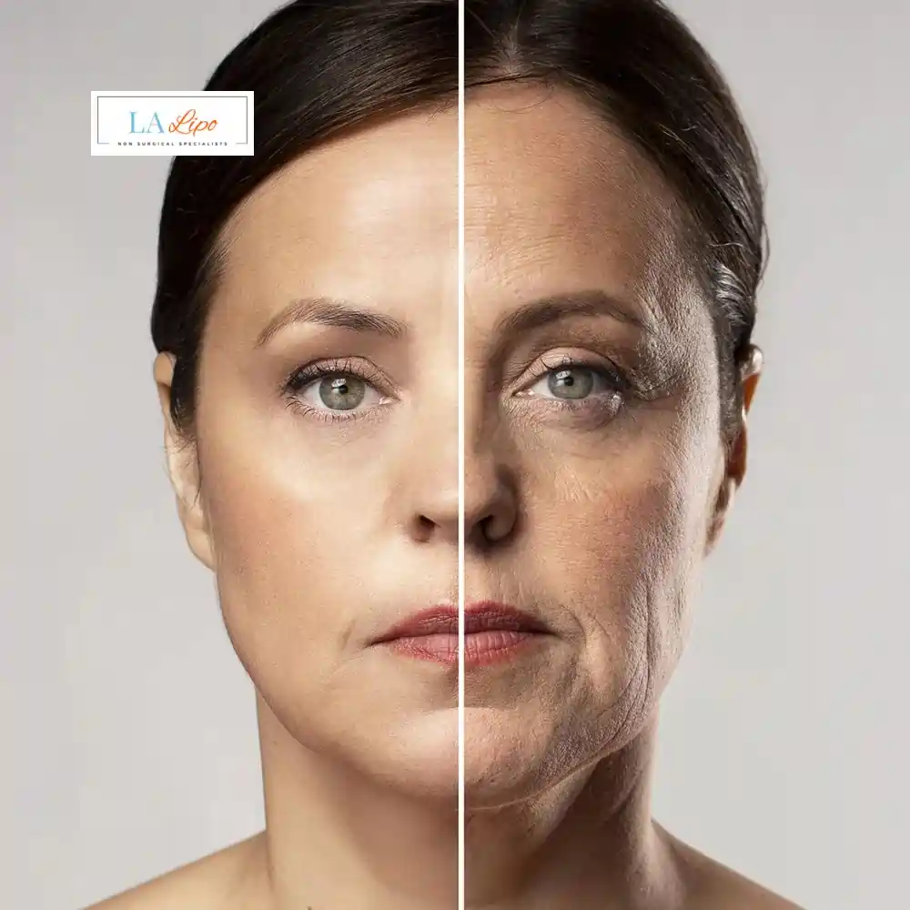 How Can You Tell If Non-Surgical Skin Tightening Is Right for You Lancaster?